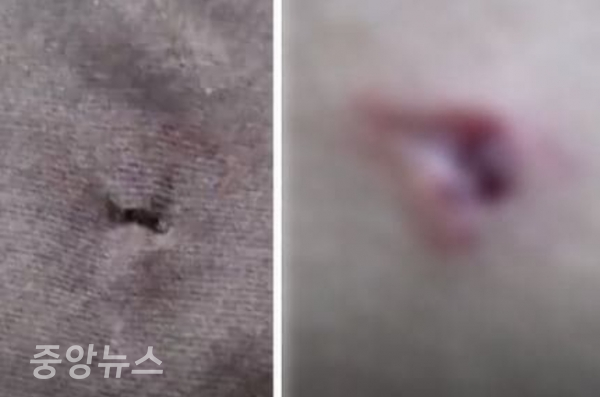 옷에 구멍이 뚫린 피해자 B군의 상처난 사진(사진=피해자 부모가 공개한 사진 캡처)