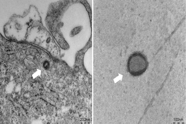 원숭이두창 바이러스 전자현미경 (사진=질병관리청)
